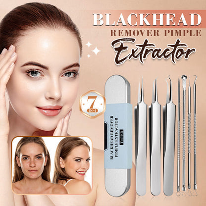 💓HOT SALE 50% OFF💥Professional Facial Stainless Steel Blackhead Removal Kit