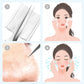 💓HOT SALE 50% OFF💥Professional Facial Stainless Steel Blackhead Removal Kit